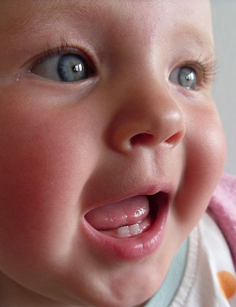 Featured image of post Dente Encavalado Nascendo Ter um dente nascendo em uma crian a pode causar alguns sintomas desconfort veis mas ainda n o se tem a confirma o de ser o ativador de